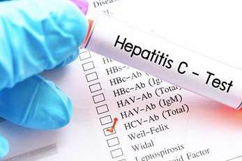 HepCAPP Study